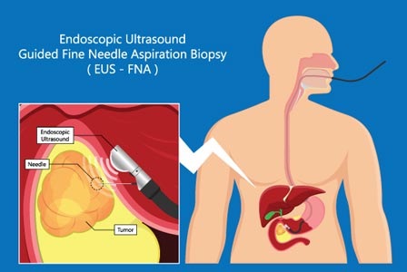 elevate-gastroenterology-eus